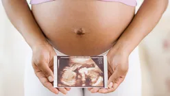 Республиканцы Аризоны хотят, чтобы школы преподавали развитие плода, но не секс, ИППП или аборты