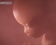 Южная Дакота принимает закон об образовании по пренатальному развитию | Live Action